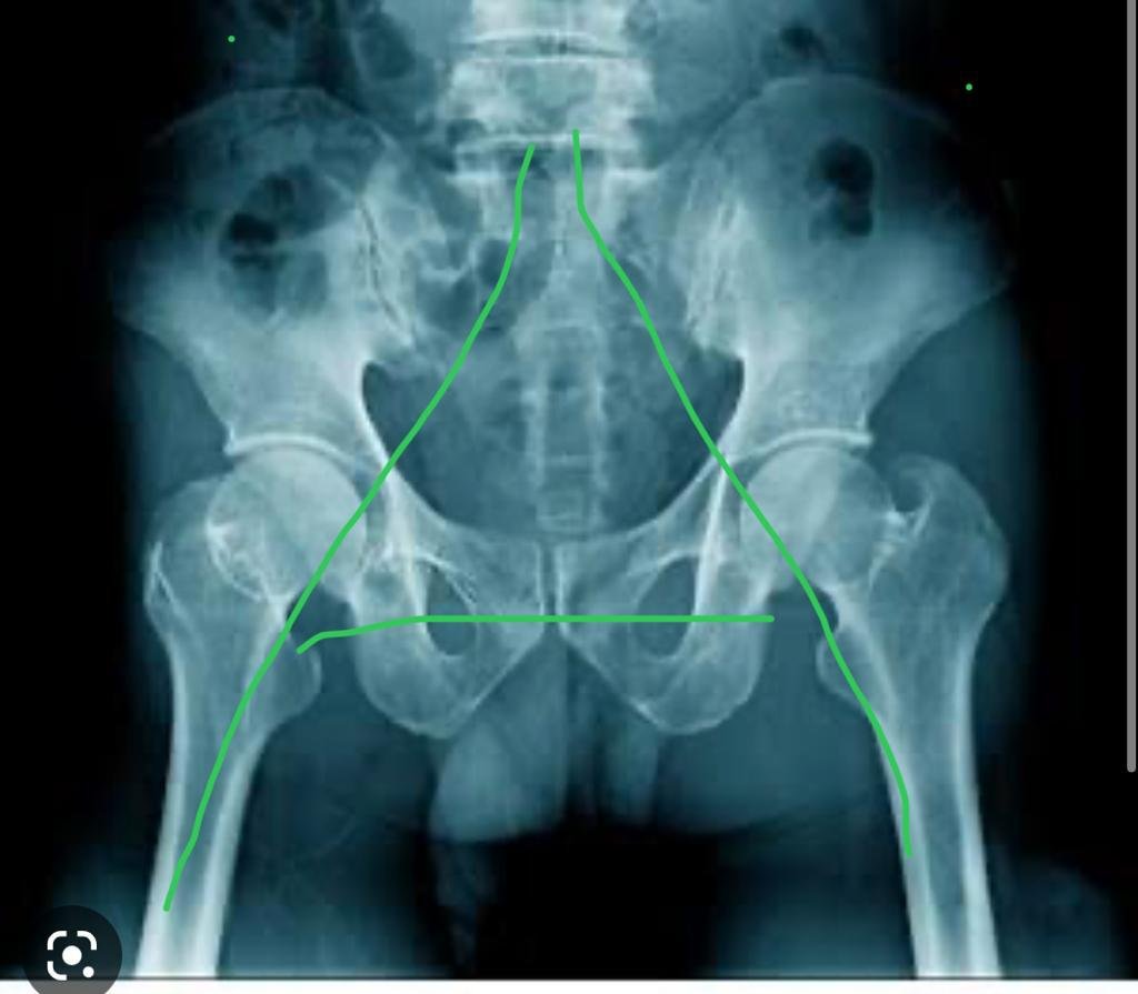 f33299ff a30b 4bc7 92f3 17b101e1c1ea